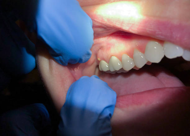 Best Emergency TMJ Treatment in Munsons Corners, NY