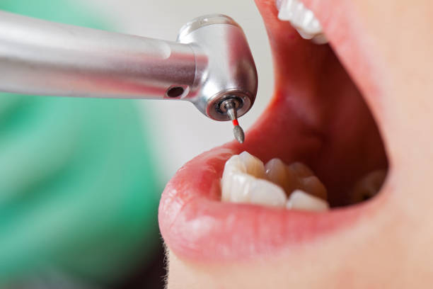 Best Emergency Gum Treatment in Munsons Corners, NY